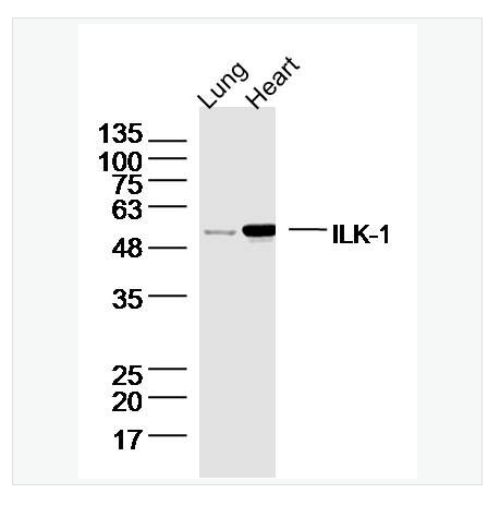 Anti-ILK-1 antibody  -整合素连接激酶-1抗体