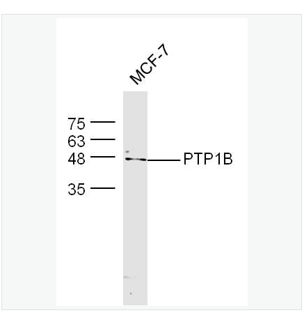 Anti-PTPN1 antibody  -蛋白酪氨酸磷酸酶-1B抗体