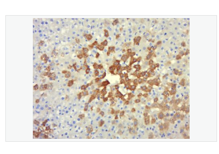 Anti-IASPP antibody  -凋亡抑制因子IASPP抗体