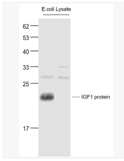 Anti-IGF 1antibody  -胰岛素样生长因子1抗体