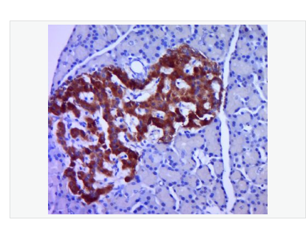 Anti-Proinsulin antibody  -胰岛素原抗体