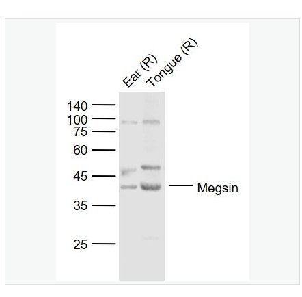 Anti-Megsin antibody  -丝氨酸蛋白酶抑制剂B7抗体