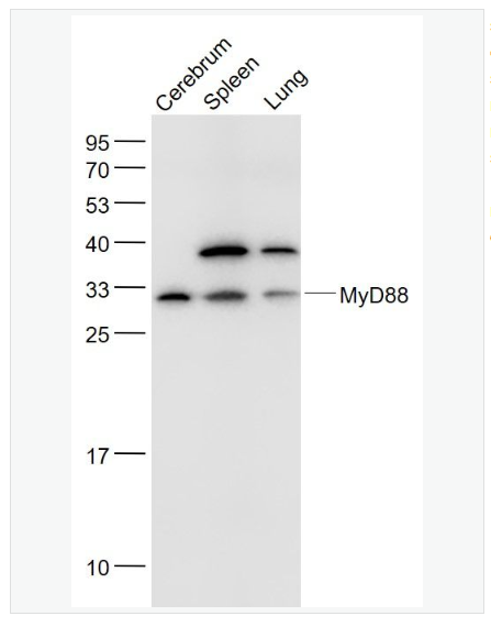 Anti-MyD88 antibody  -髓样分化蛋白抗体