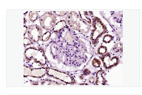 Anti-Nestin antibody  -巢蛋白/神经上皮干细胞蛋白抗体