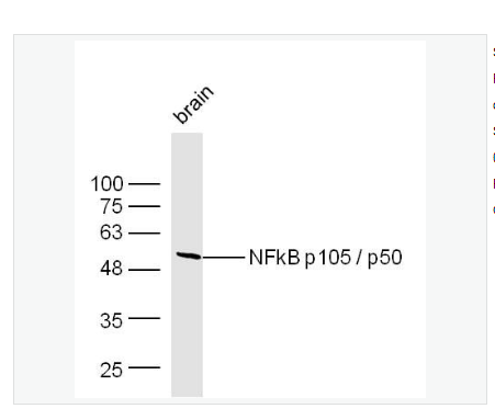 Anti-NFKB1antibody  -细胞核因子p50/k基因结合核因子抗体