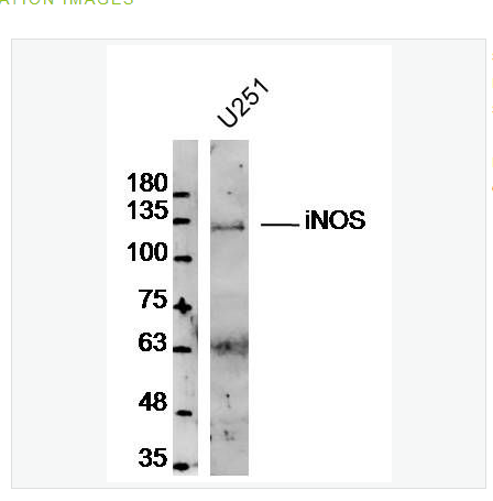 Anti-iNOS antibody  -一氧化氮合成酶-2（诱导型）抗体