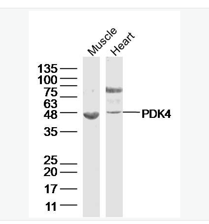 Anti-PDK4 antibody  -丙酮酸脱氢酶激酶4抗体
