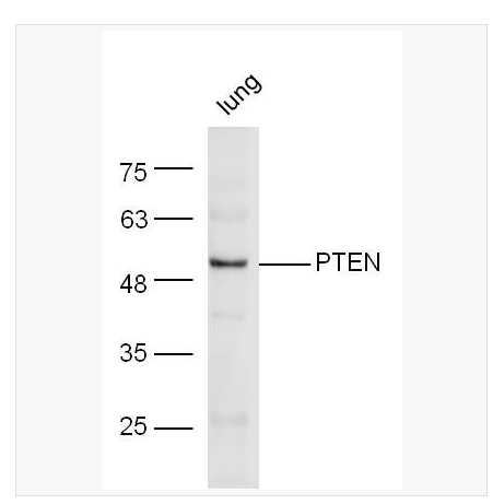 Anti-PTEN antibody  -磷酸酶和张力蛋白同系物抗体
