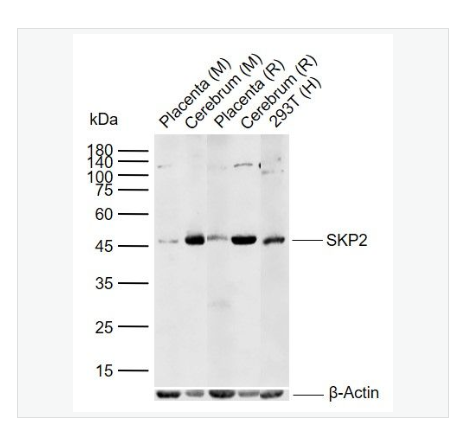 Anti-SKP2 antibody  -细胞S期激酶相关蛋白2抗体