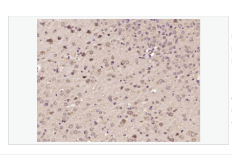 Anti-STAT6 antibody  -信号转导和转录激活因子6抗体