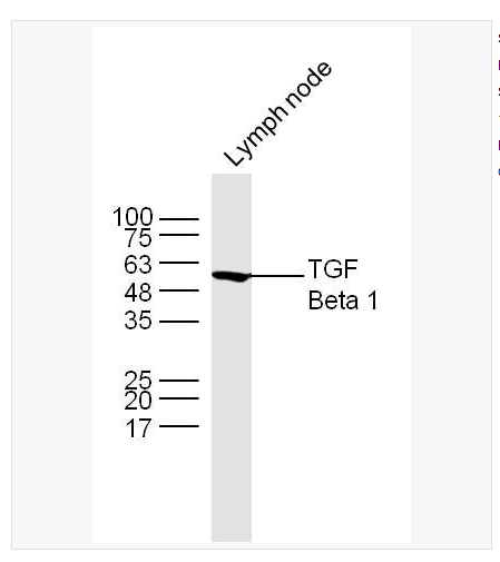 Anti-TGF Beta 1 antibody  -转化生长因子β1抗体