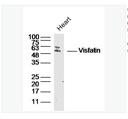 Anti-Visfatin antibody  -内脂素/内脏脂肪素/前B细胞克隆增强因子1抗体