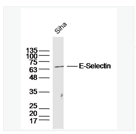 Anti-E-Selectin antibody  -E选择素抗体