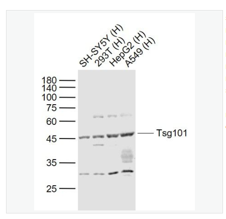Anti-TSG101 antibody  -肿瘤易感基因101蛋白抗体