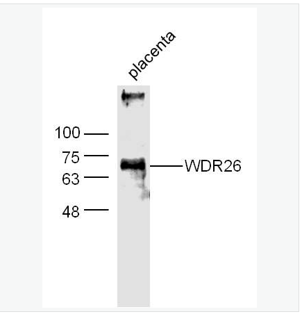 Anti-WDR26  antibody  -心肌缺血预处理正调节蛋白2抗体