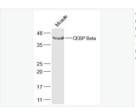 Anti-CEBP Beta  antibody  -转录调节因子C/EBP β抗体