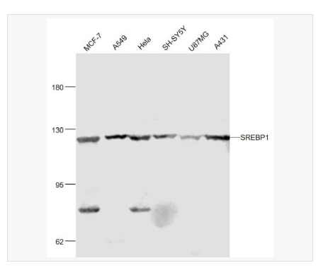 Anti-SREBP1  antibody  -胆固醇调节元件结合蛋白1抗体