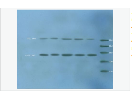 Anti-HIF 2 alpha  antibody  -缺氧诱导因子2α /EPAS1抗体