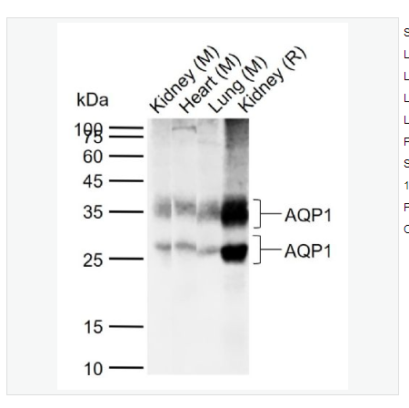 Anti-AQP1 antibody  -水通道蛋白1抗体