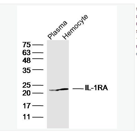 Anti-IL-1RA antibody  -白介素-1受体拮抗剂抗体