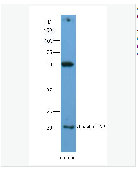 Anti-phospho-BAD antibody  -磷酸化相关死亡促进因子抗体