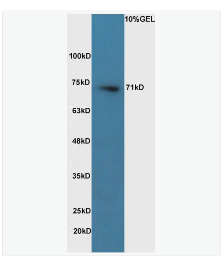 Anti-Pro-neuregulin-1 antibody  -神经胶质生长因子/神经调节蛋白β抗体