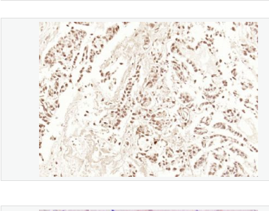 Anti-HDAC3 antibody  -组蛋白去乙酰化酶3抗体