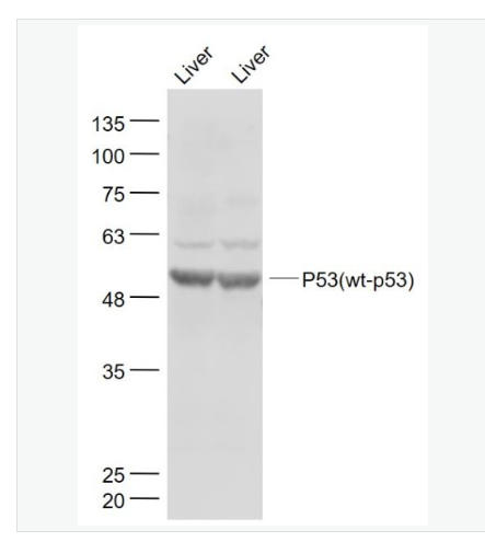 Anti-P53(wt-p53) antibody  -野生型P53肿瘤抑制基因抗体