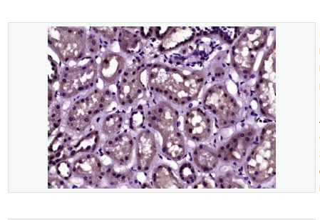 Anti-Phospho-Histone H3 antibody  -磷酸化组蛋白H3抗体