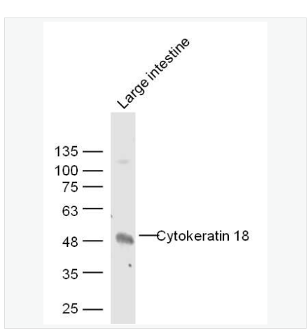 Anti-CK18 antibody  -细胞角蛋白18抗体