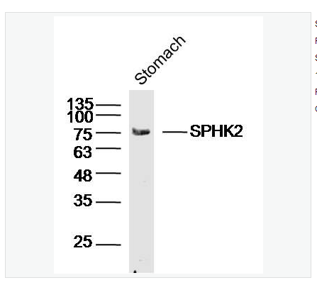 Anti-SPHK2 antibody  -鞘氨醇激酶2抗体