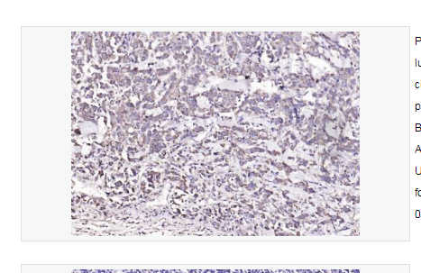 Anti-CD134 antibody  -CD134抗体