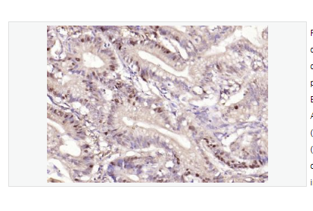 Anti-Phospho-Beta-Cateninantibody  -磷酸化β 连环素蛋白抗体