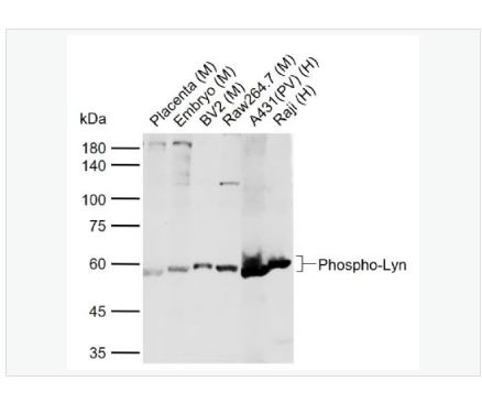 Anti-Phospho-Lyn  antibody  -磷酸化膜相关蛋白酪氨酸激酶Lyn抗体