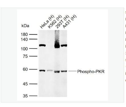 Anti-Phospho-PKR antibody  -磷酸化干扰素诱导的双链RNA活化蛋白激酶抗体