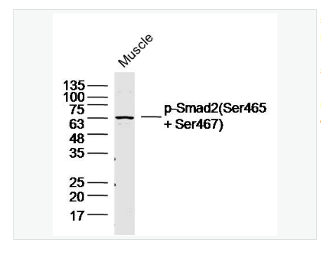 Anti-Phospho-Smad2 antibody  -磷酸化细胞信号转导分子SMAD2抗体