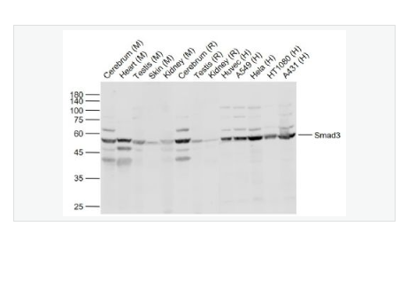 Anti-Smad3 antibody  -细胞信号转导分子SMAD3抗体