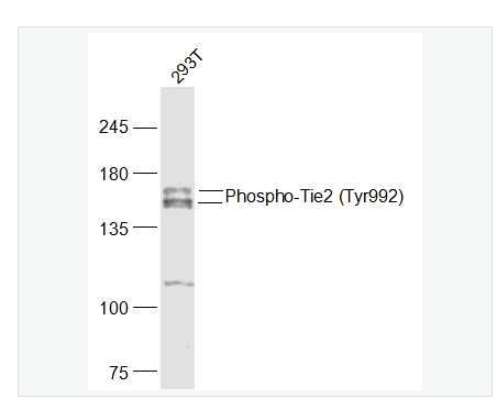 Anti-Phospho-Tie2 antibody  -磷酸化血管生成素受体2抗体