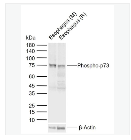 Anti-Phospho-p73 antibody  -磷酸化肿瘤蛋白P73抗体