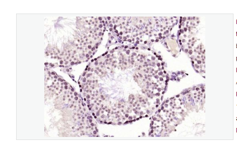 Anti-phospho-PKC delta antibody  -磷酸化蛋白激酶C亚性D型抗体