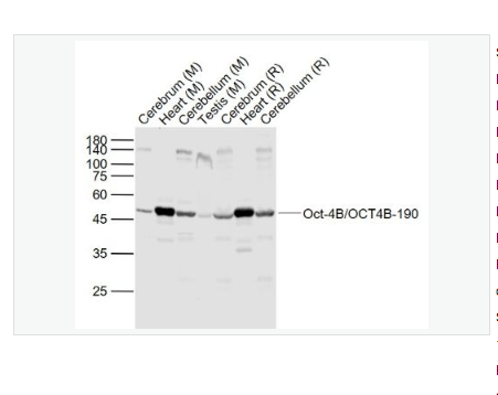 Anti-Oct-4B/OCT4B-190 antibody  -胚胎干细胞关键蛋白190抗体(N端)