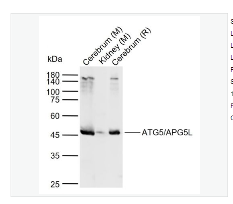 Anti-ATG5/APG5L antibody  -自噬蛋白5/细胞凋亡的特异性蛋白抗体