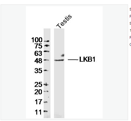 Anti-LKB1  antibody  -苏氨酸蛋白激酶LKB1抗体