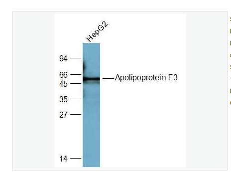 Anti-Apolipoprotein E3 antibody  -载脂蛋白E3抗体