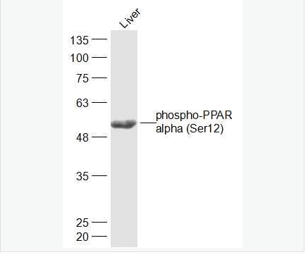 Anti-phospho-PPAR alpha antibody  -磷酸化α型-过氧化酶活化增生受体抗体