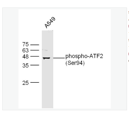 Anti-phospho-ATF2 antibody  -磷酸化活化复制因子2抗体