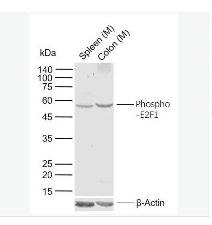 Anti-phospho-E2F1 antibody  -磷酸化转录因子E2F-1抗体