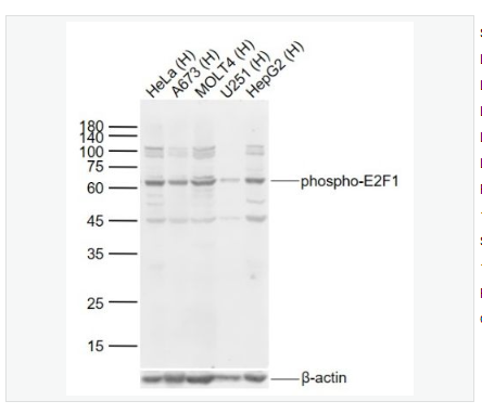 Anti-phospho-E2F1  antibody  -磷酸化转录因子E2F-1抗体