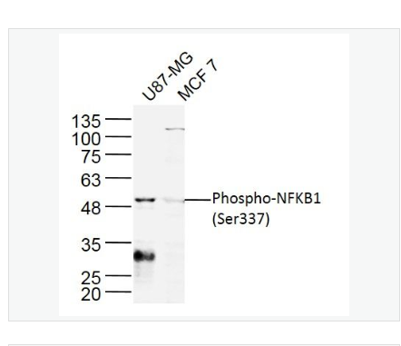 Anti-Phospho-NFKB1  antibody  -磷酸化细胞核因子p50/k基因结合核因子抗体