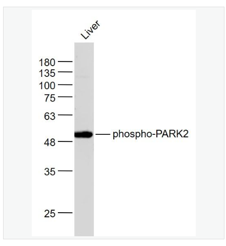 Anti-phospho-PARK2  antibody  -磷酸化帕金蛋白抗体